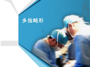 多指畸形.ppt