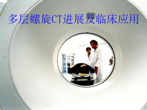 多层螺旋CT进展及临床应用.ppt
