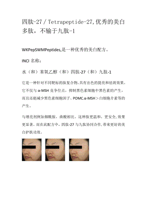 四肽-27_Tetrapeptide-27优秀的美白多肽不输于九肽-1.docx