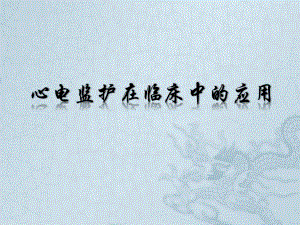 心电监护在临床中的应用.ppt