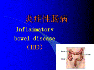 炎症性肠病.ppt