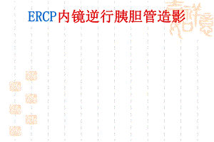 ERCP业务学习.ppt