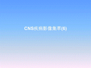 CNS疾病MRI诊断.ppt