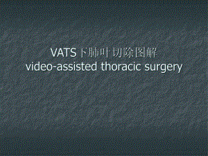 vats肺叶切除.ppt