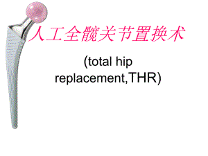 人工全髋关节置换.ppt