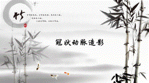 冠状动脉造影.ppt