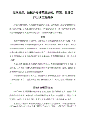 临床肿瘤、结核分枝杆菌肺结核、真菌、脓肿等肺出现空洞要点.docx