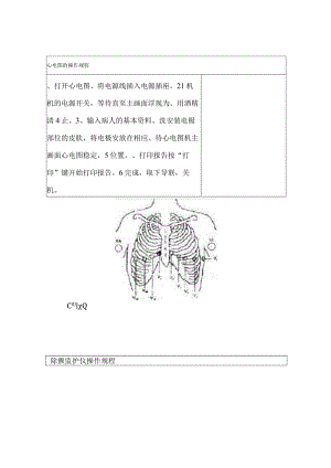 心电图的操作规程.docx