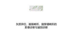 灰质异位、脑裂畸形、脑穿通畸形的影像诊断与鉴别诊断.docx