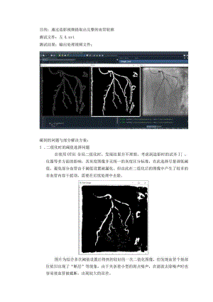 心脏造影血管提取.docx