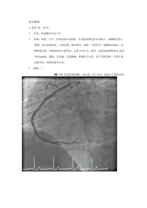 RCA开口左面.docx