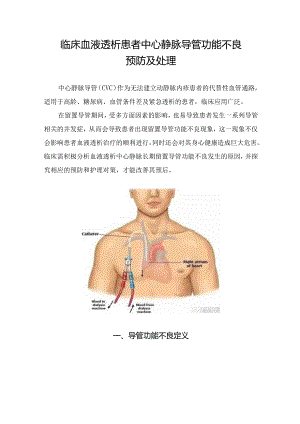 临床血液透析患者中心静脉导管功能不良预防及处理.docx