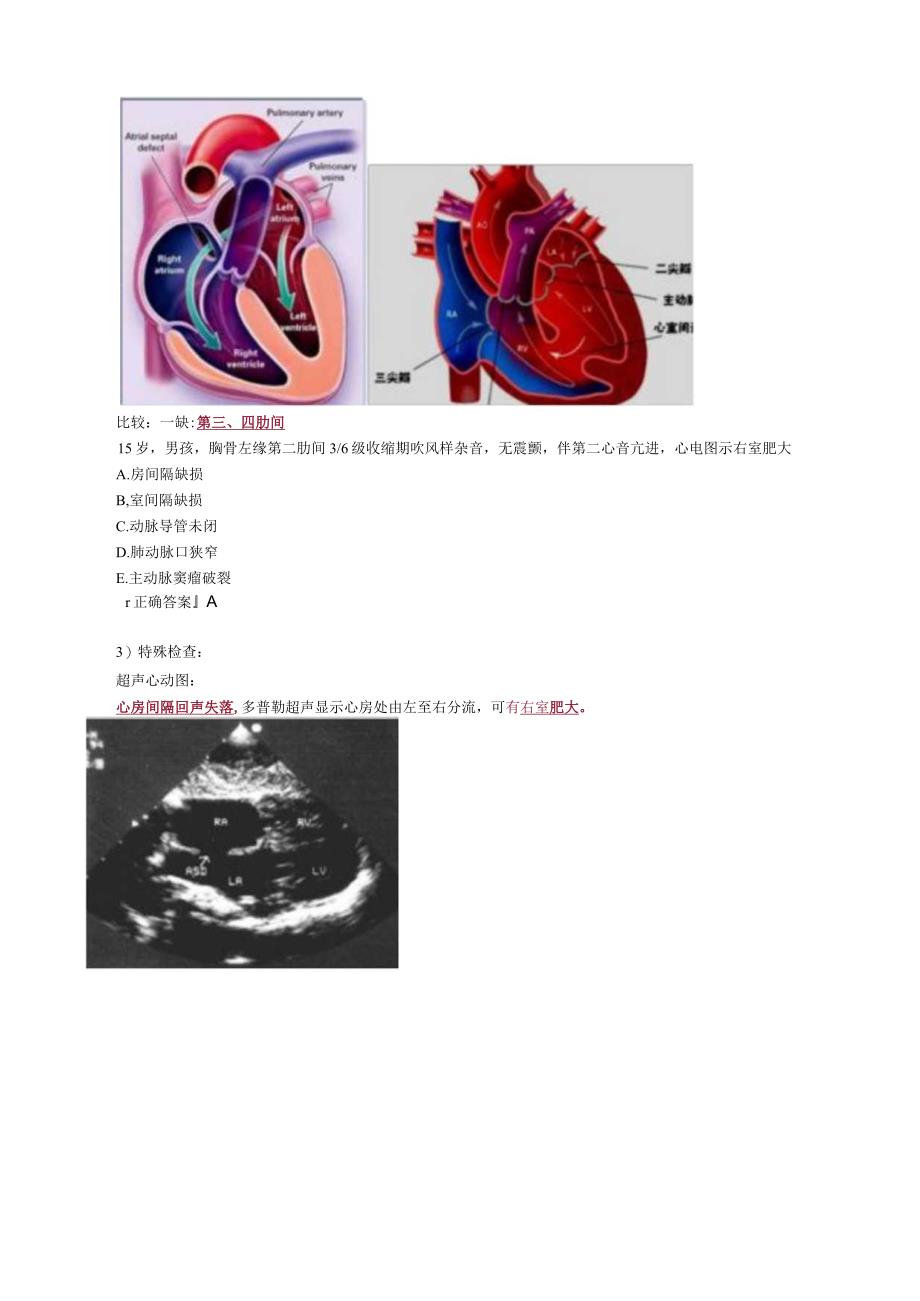 心血管内科主治医师资格笔试专业实践能力考点解析 (5):先天性心血管病.docx_第2页
