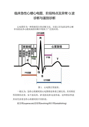 临床急性心梗心电图、阶段特点及异常Q波诊断与鉴别诊断.docx