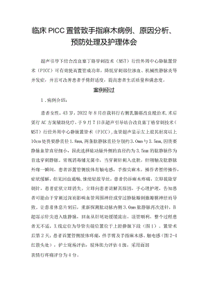 临床PICC置管致手指麻木病例、原因分析、预防处理及护理体会.docx