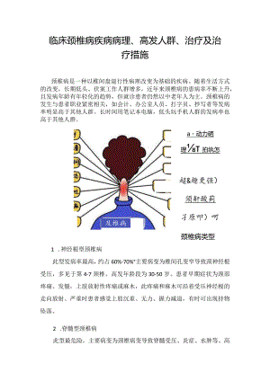 临床颈椎病疾病病理、高发人群、治疗及治疗措施.docx