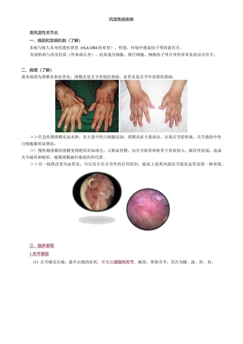 心血管内科主治医师资格笔试相关专业知识考点解析 (7):风湿免疫病学.docx_第1页