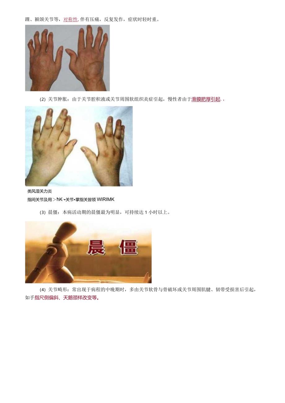 心血管内科主治医师资格笔试相关专业知识考点解析 (7):风湿免疫病学.docx_第2页