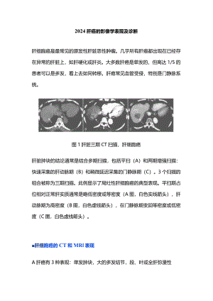 2024肝癌的影像学表现及诊断.docx