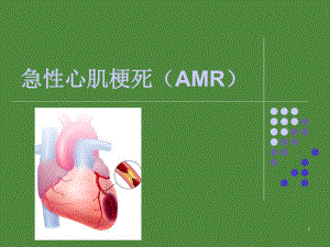 急性心肌梗死护理查房.ppt