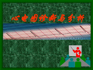 心电图诊断与分析.ppt