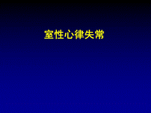 室性心律失常.ppt