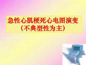 急性心肌梗死心电图演变.ppt
