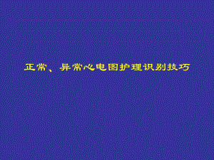 正常、异常心电图护理识别技巧.ppt.ppt