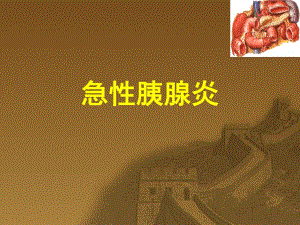 急性胰腺炎.ppt