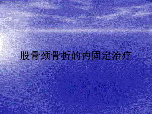 股骨颈骨折的内固定治疗.ppt