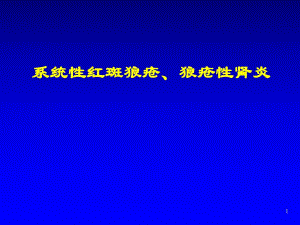 系统性红斑狼疮、 狼疮性肾炎诊治进展.ppt
