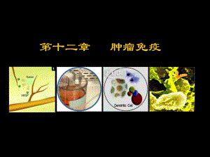 第十二章肿瘤免疫.ppt