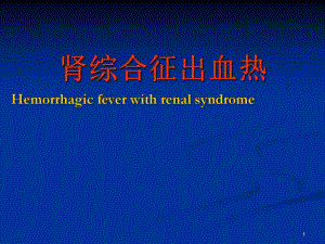 肾综合征出血热.ppt