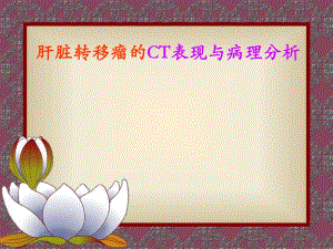 肝脏转移瘤的CT表现与病理幻灯.ppt