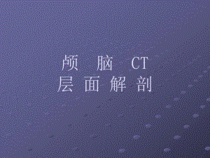 颅脑CT层面解剖.ppt