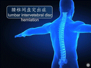 腰椎间盘突出.ppt