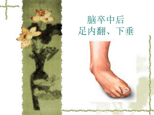 脑卒中后足内翻、下垂.ppt