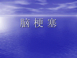 脑梗塞演示文稿.ppt.ppt