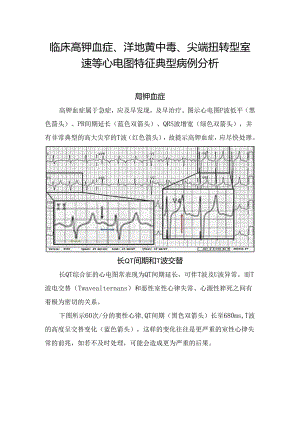 临床高钾血症、洋地黄中毒、尖端扭转型室速等心电图特征典型病例分析.docx