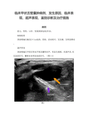 临床甲状舌管囊肿病例、发生原因、临床表现、超声表现、鉴别诊断及治疗措施.docx