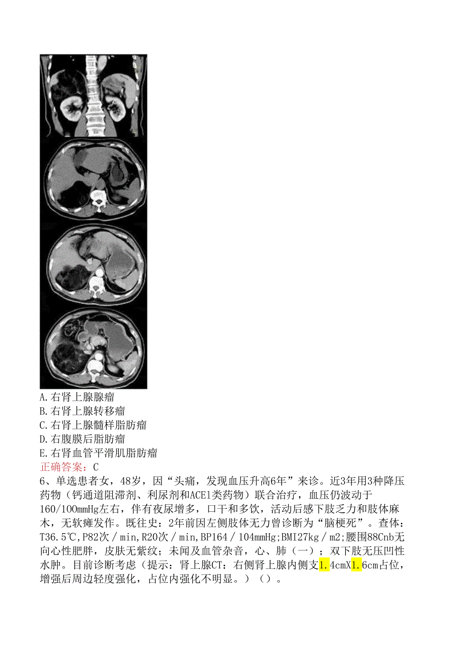 内分泌学(医学高级):肾上腺疾病测试题五.docx_第2页