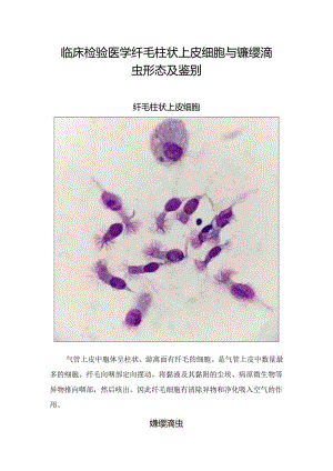 临床检验医学纤毛柱状上皮细胞与蠊缨滴虫形态及鉴别要点.docx