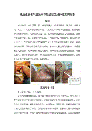 硬皮症患者气道狭窄导致插管困难护理案例分享.docx
