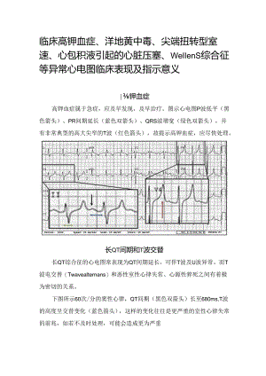 临床高钾血症、洋地黄中毒、尖端扭转型室速、心包积液引起的心脏压塞、Wellens综合征等异常心电图临床表现及指示意义.docx