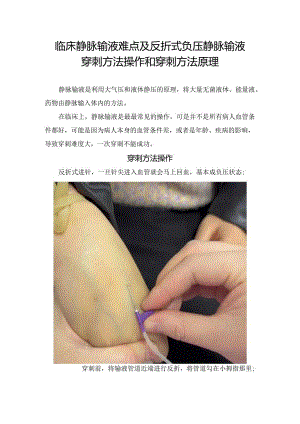 临床静脉输液难点及反折式负压静脉输液穿刺方法操作和穿刺方法原理.docx