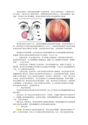 鼻息肉的诊断和治疗及并发症(探讨).docx