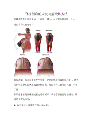 脊柱侧弯的康复功能锻炼方法.docx