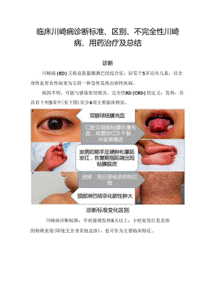临床川崎病诊断标准、区别、不完全性川崎病、用药治疗及总结.docx