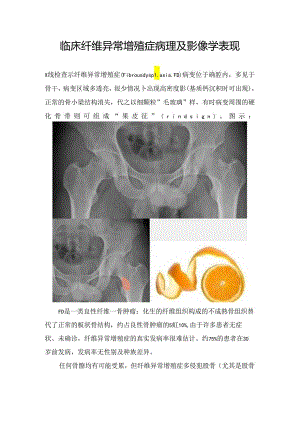 临床纤维异常增殖症病理及影像学表现.docx