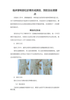 临床穿刺部位淤青形成原因、预防及处理要点.docx